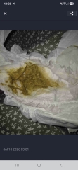CMPA query *[Content warning: nappy pics included]