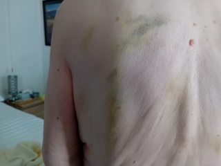Mounjaro - 10 Stone or more to lose - Thread 14