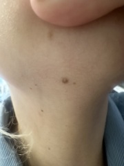 Mole 2ww