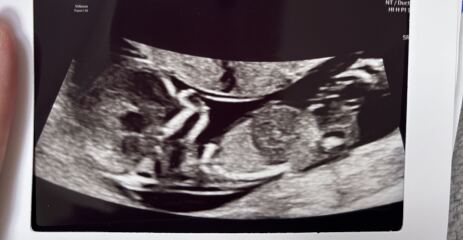 Girl or Boy?🤍