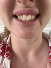 To really despise my teeth!!