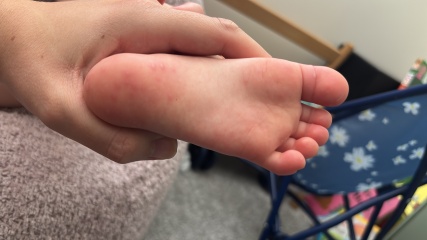 Does this look like HFM?