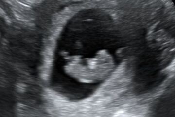 10 weeks any clues? 💗💙