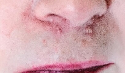 Are these spots due to menopause?