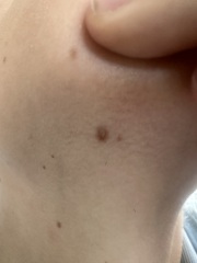 2ww mole