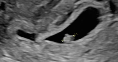 Due March 2027