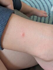 Spots