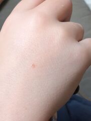 Spots