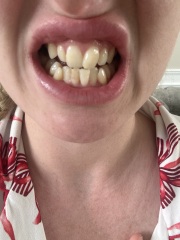 To really despise my teeth!!