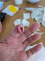 Gruesome (minor) accident