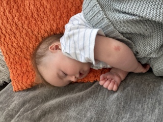 Rash on baby