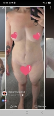 Anyone considering a tummy tuck after losing weight with injections?