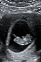 10 weeks any clues? 💗💙