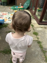 Baby flat spot on head