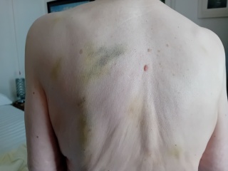 Mounjaro - 10 Stone or more to lose - Thread 14