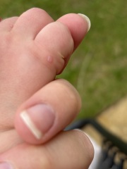 Does this look like HFM?