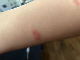 Bed bugs!
