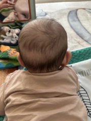 Baby flat spot on head
