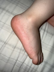 How long does hand, foot and mouth usually last in toddlers?