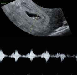 Due March 2027
