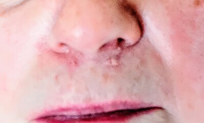 Are these spots due to menopause?