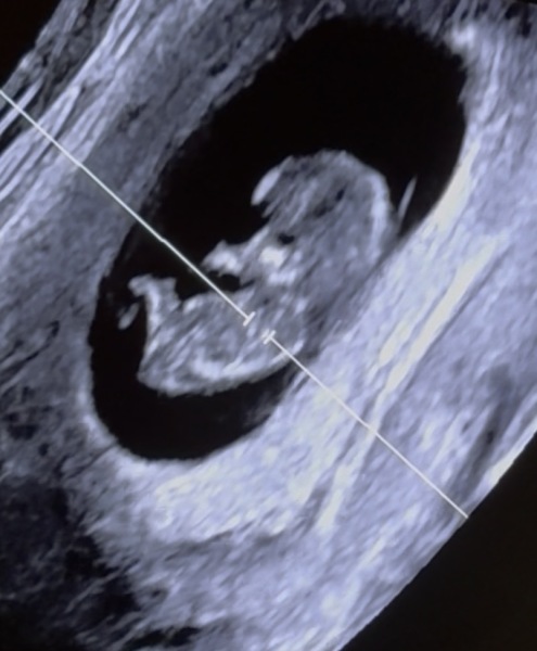 thoughts on Paternity/help with conception. TW/ assault