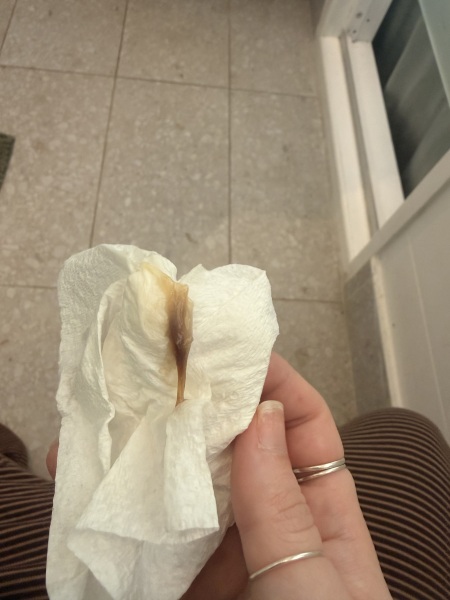 Mucus plug? Irritated cervix? Or bloody show? **PHOTOS**