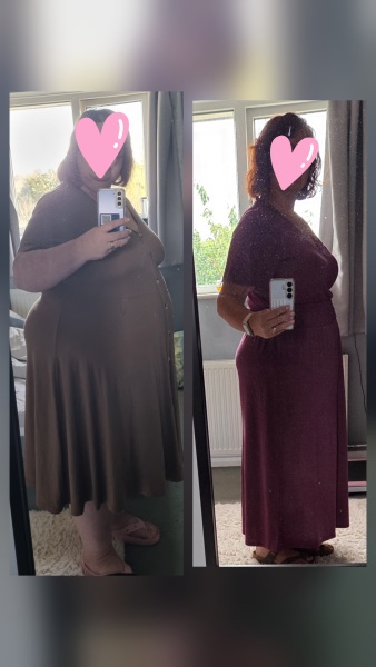 Mounjaro - 10 stone or more to lose - Thread 15.
