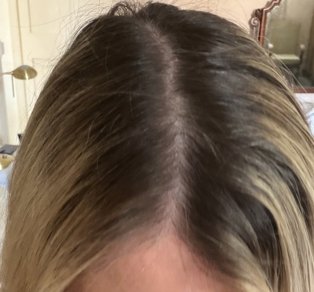 Highlight regrowth quick fix? (Pic)