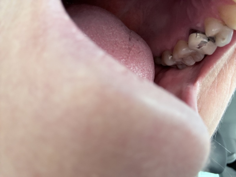 Are there any Dentist say who could help identify what this is?