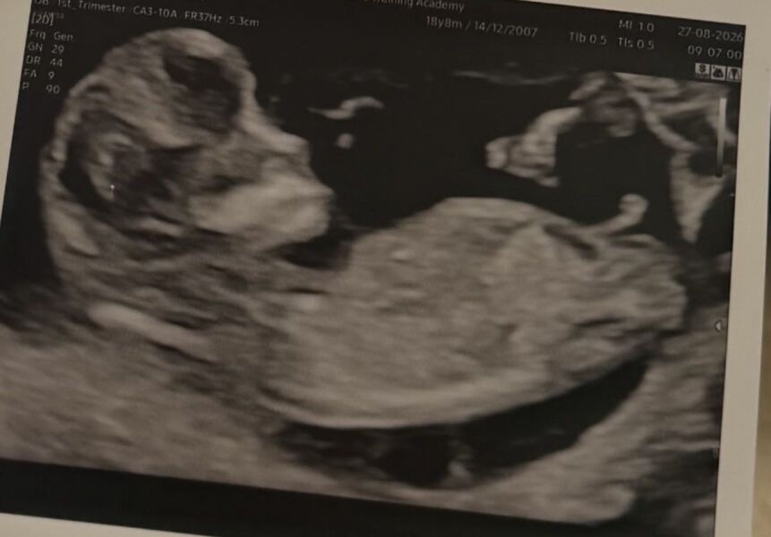 Boy or girl?? Scan picture
