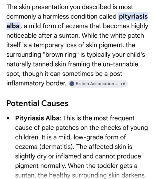 To be shocked by multiple white patches on child’s face after foreign sun exposure