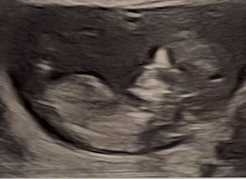 Any nub guesses on another family baby prediction this time?