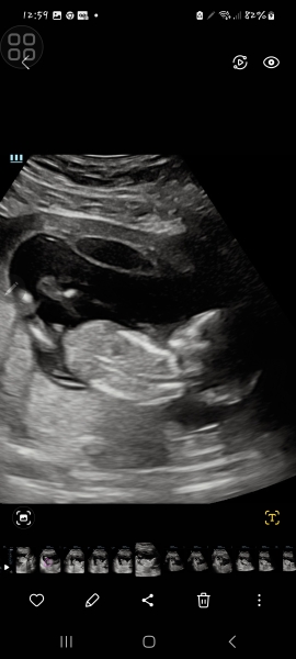 Gender 14 weeks GUESS
