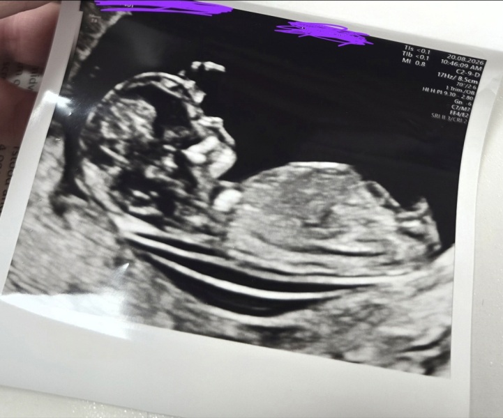 Due March 2027