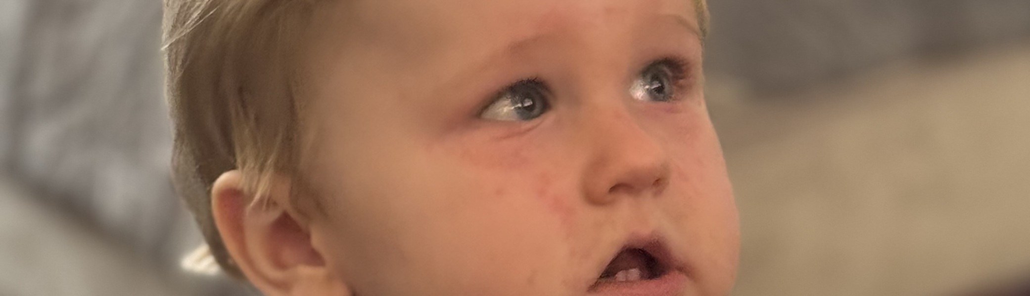 Anyone experienced persistent red spots on a baby's face?