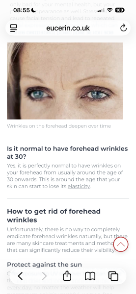 Experiences of baby Botox for early forehead lines and wrinkles