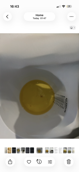 Is this possible blood in my urine