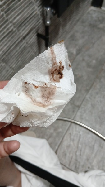 Brown discharge and light bleeding at 12 weeks, worried about pregnancy loss