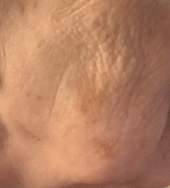 Help! How can I improve my skin?