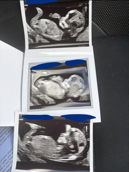 Gender guess?