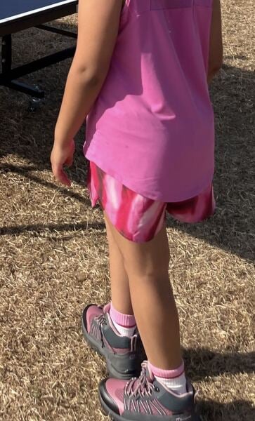 Overweight child