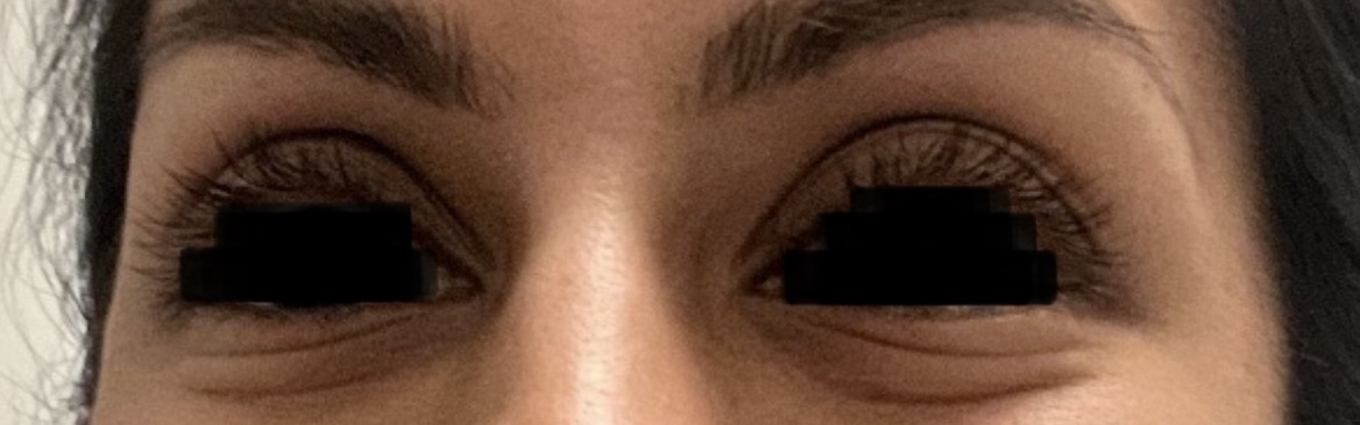 Ageing undereyes - still in 20s, any tips