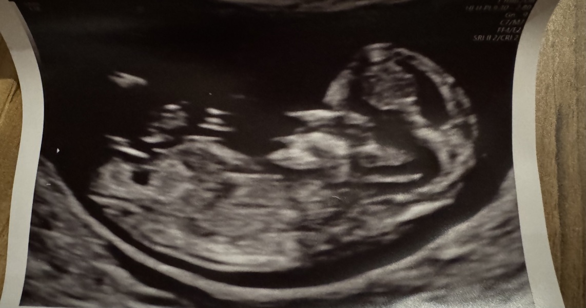 Pregnancy