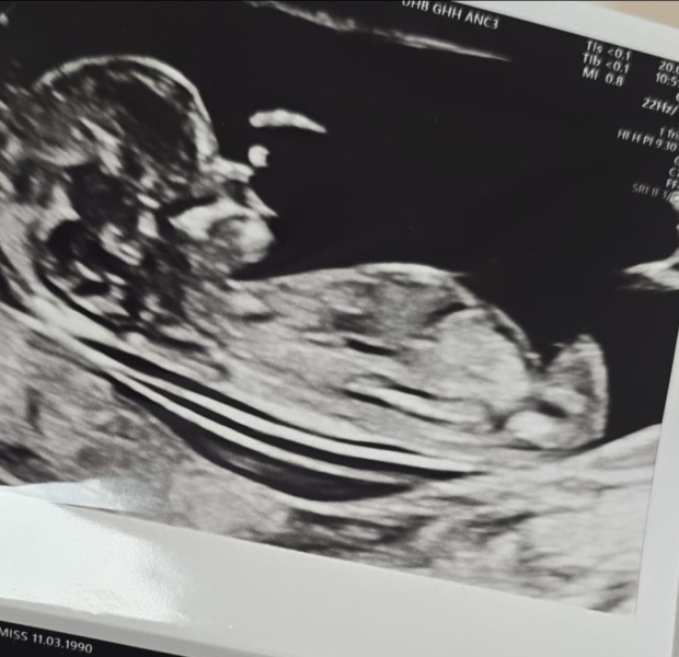Nub theory - 12 week ultrasound. - guesses please!!