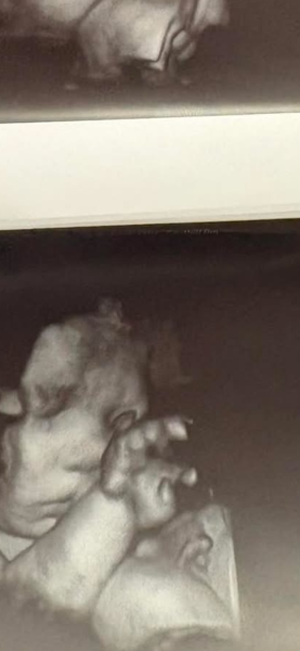Gender?