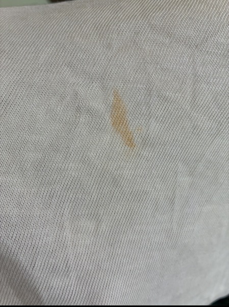 How can I get a tomato stain out of a cotton top? Only worn once!! 😭