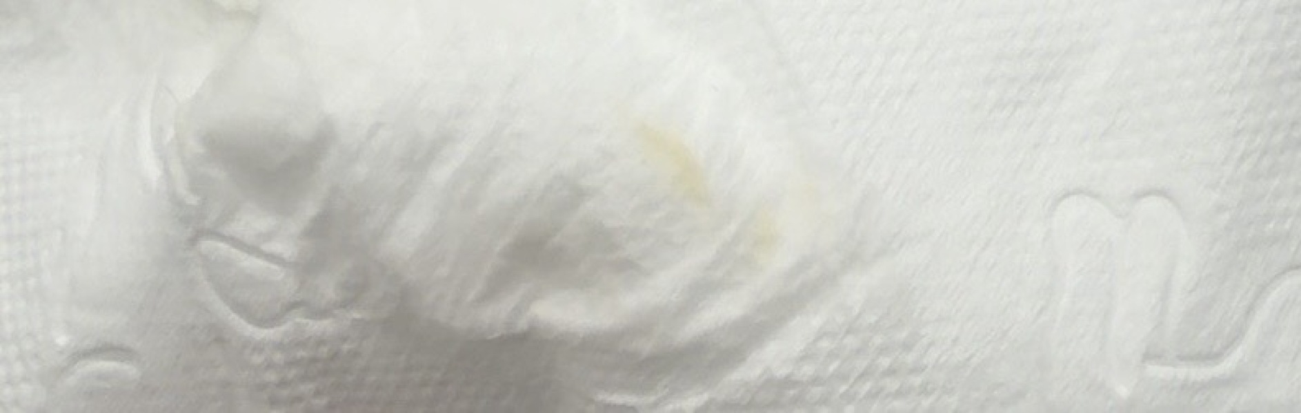 Early pregnancy symptoms of UTI 5 weeks tomorrow
