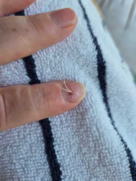 Sewn through finger