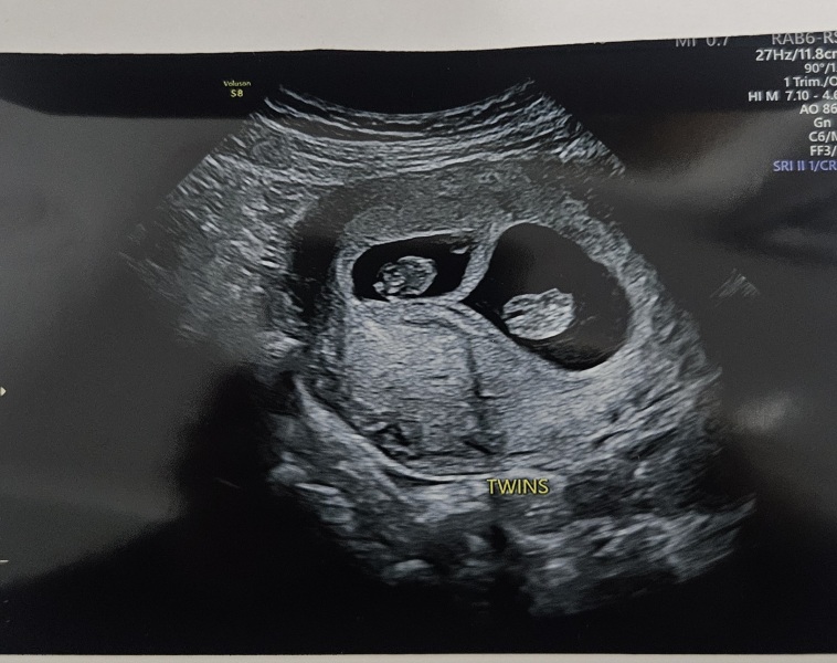 Due March 2027